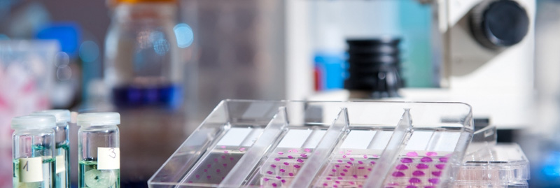 Badanie CERTAIN — test CINtec® Histology