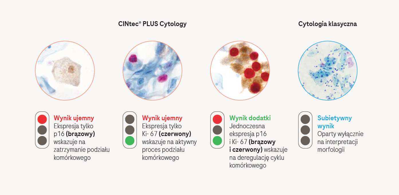 CINtec® PLUS Cytology — klarowność i powtarzalność wyników