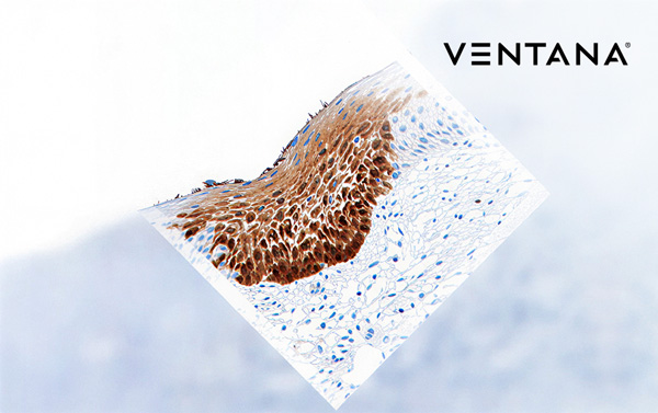 Test CINtec® Histology