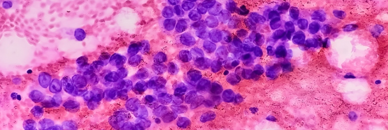 Test CINtec® PLUS Cytology