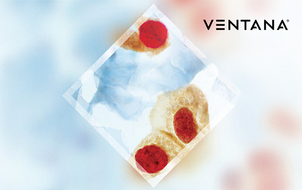 Test CINtec® PLUS Cytology